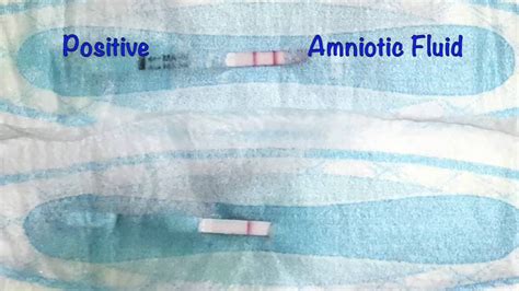 how to tell if leaking amniotic fluid|Leaking amniotic fluid (premature rupture of membranes)